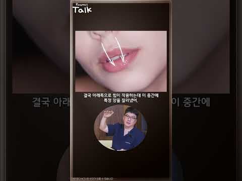 인중축소, 몇mm까지가 안 어색할까?
