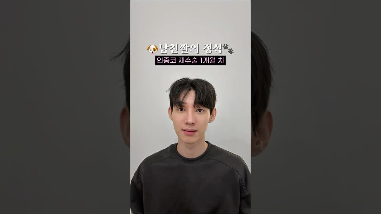 남자 코수술도 리스펙✨전후를 비교해 보면입이 나와 보이던 느낌은 자연스럽게 개선되고,처져 보이던 코끝은 더욱 또렷하게😎