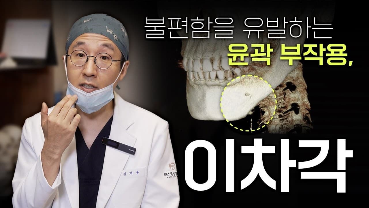윤곽 수술 부작용 이차각, 발생 원인과 해결 방법은?