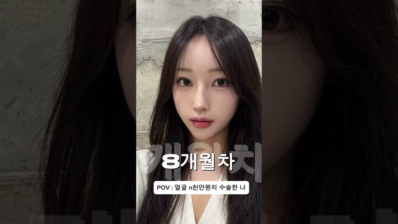 POV : 얼굴 n천만원치 수술한 나
